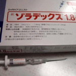 醋酸戈舍瑞林缓释植入剂(zoladex la 10.8mg depot)