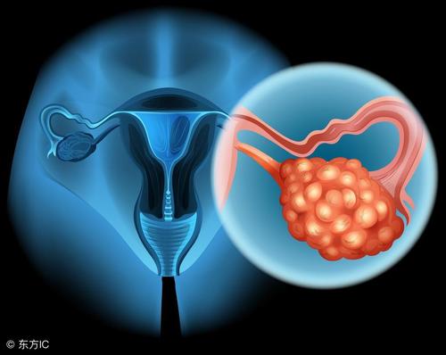 卵巢癌BRCA1/2基因检测项目